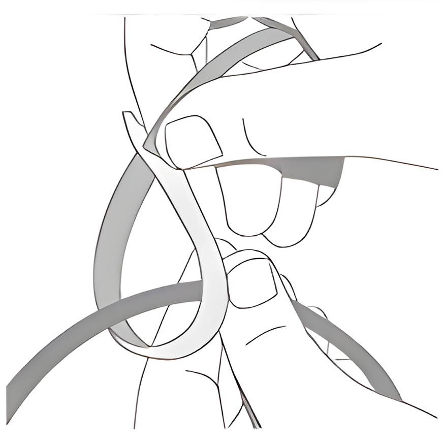 Step 1  Secure the tie